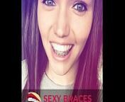 Cute Girls With Braces Showing their smile! from www xviods com sex xx