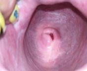 Cervix close up [4k] from sexxxn bho